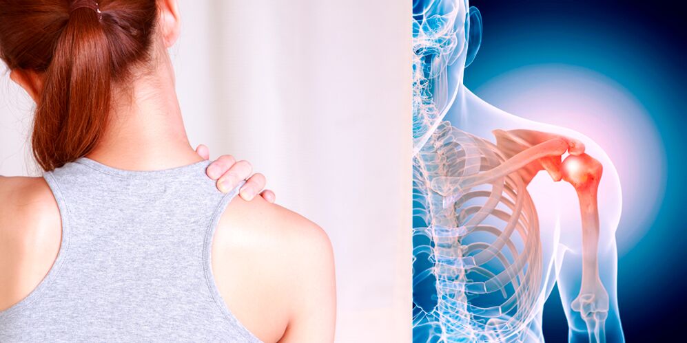 Развој остеоартритиса рамена постепено доводи до сталног бола